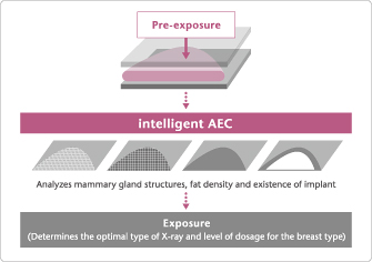 [Imagem] Intelligent AEC otimiza a dose de raios X para cada tipo de mama