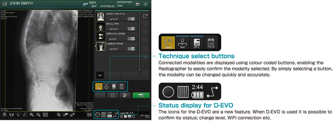 [Imagem] Novo CONSOLE ADVANCE com funções melhoradas para FDR D-EVO