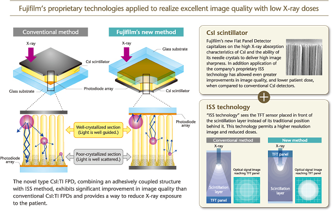 [Imagem] Tecnologias proprietárias da Fujifilm aplicadas para conseguir qualidade de imagem excelente com doses baixas de raios X